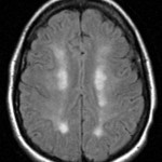 internal